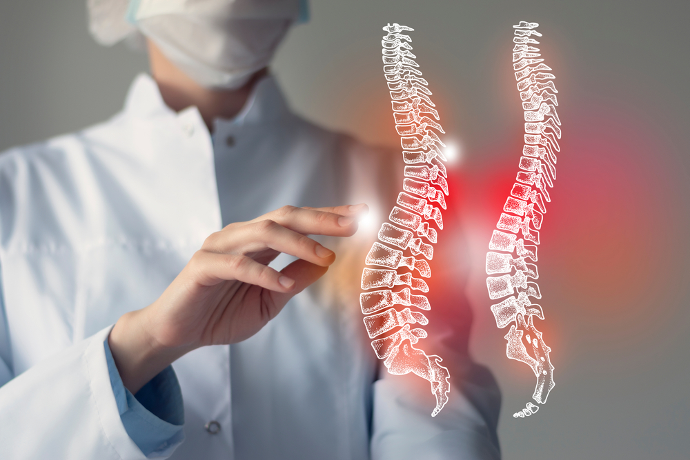 Most Effective Non Surgical Treatments for Spinal Stenosis