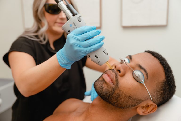 Are You Making These 3 Critical Mistakes Before Your Laser Hair Removal in North York, Toronto?